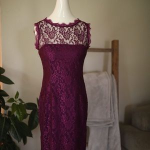GORGEOUS Lace Dress